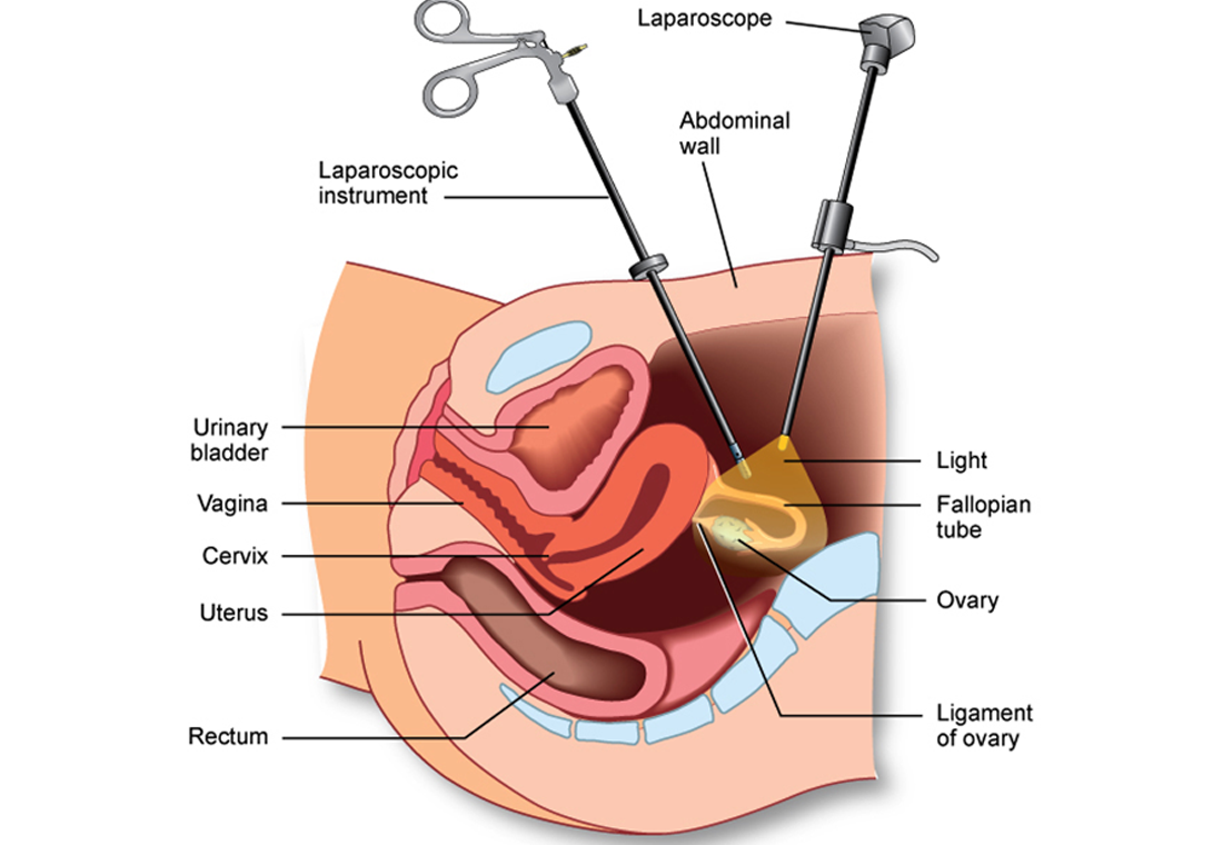 gallbladder surgery in jaipur